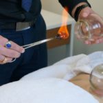 Cupping Therapy: Explore Healing Benefits in Melbourne