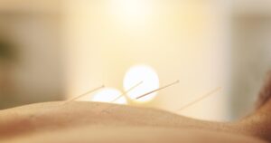 Acupuncture Benefits for Natural Recovery Explained