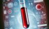 Vitamin B12 Blood Test Tips for Residents of Bridlington