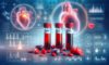 Cholesterol Blood Test: Vital Health Insights for Milton Keynes